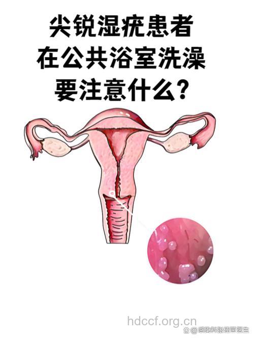 洗澡也可治疗皮肤癌