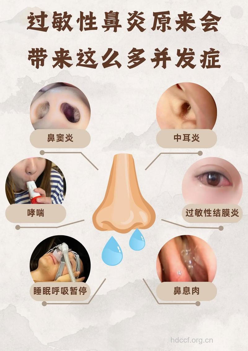 过敏性鼻炎有什么样的并发症