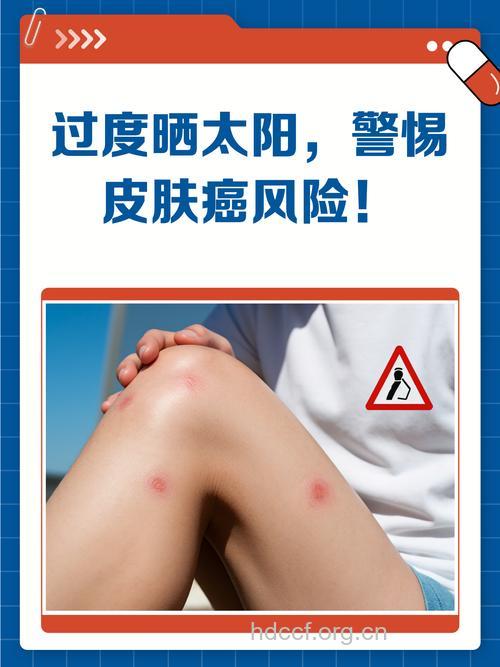 过度曝晒会不会导致皮肤癌