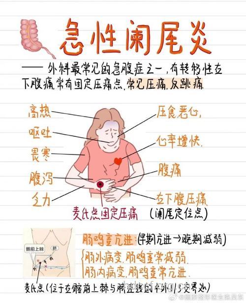 阑尾炎穿孔是宫外孕的高危因素