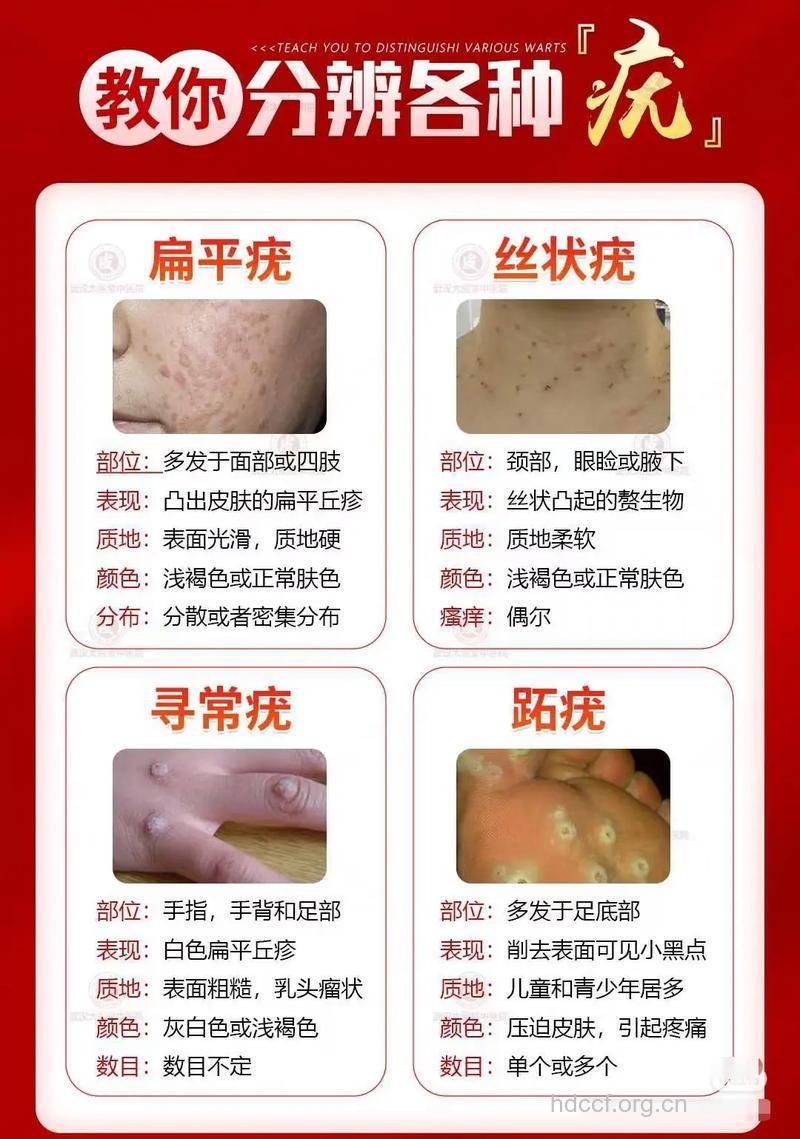 如何鉴别皮肤病与皮肤癌