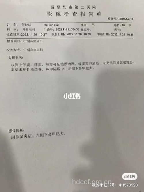 病例：鼻中隔偏曲加重鼻炎