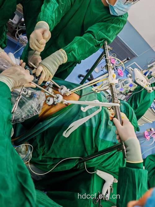 全程关注食管癌的手术治疗