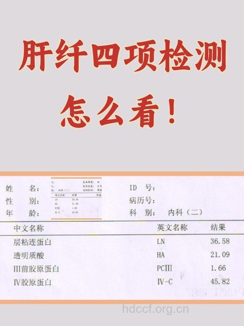 肝纤维化四项检查指标
