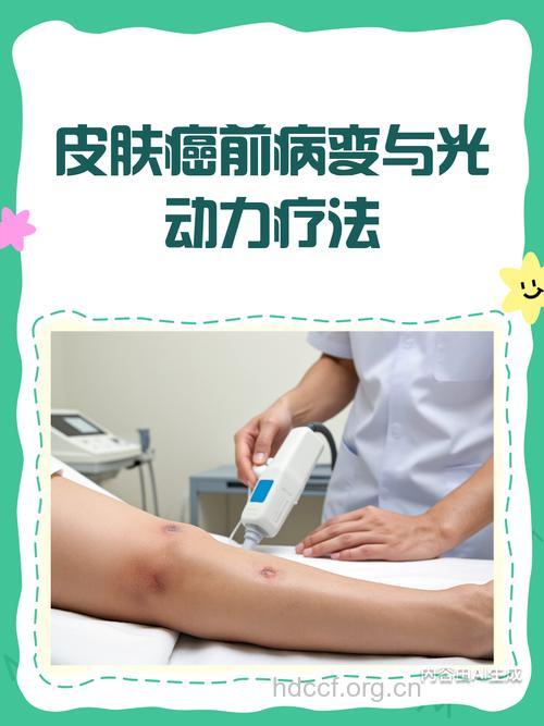专家称日光疗法可治疗皮肤癌