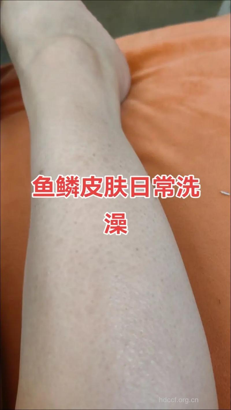 洗澡频繁容易导致皮肤起“鱼鳞”