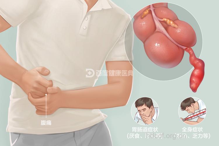 急性阑尾炎“恋上了”中青年