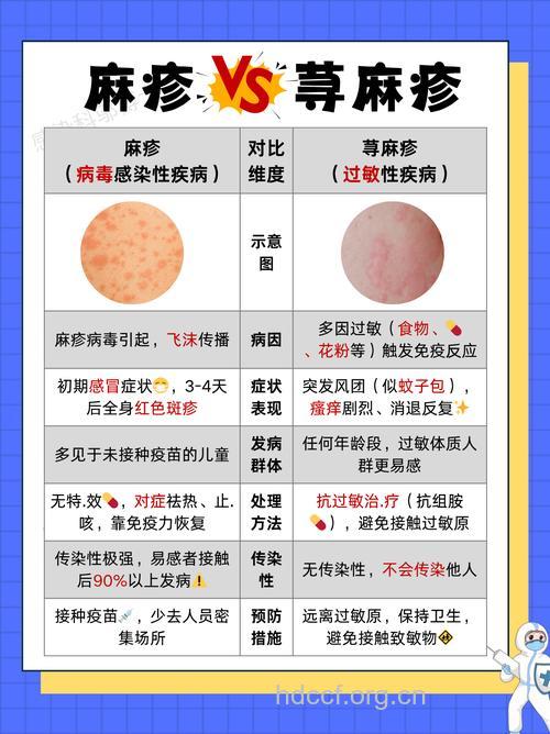 荨麻疹与其它疾病的鉴别