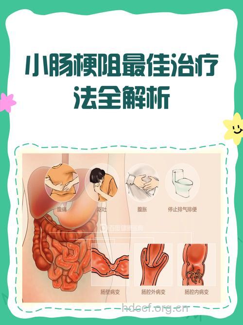 小儿肠梗阻防治专家支招