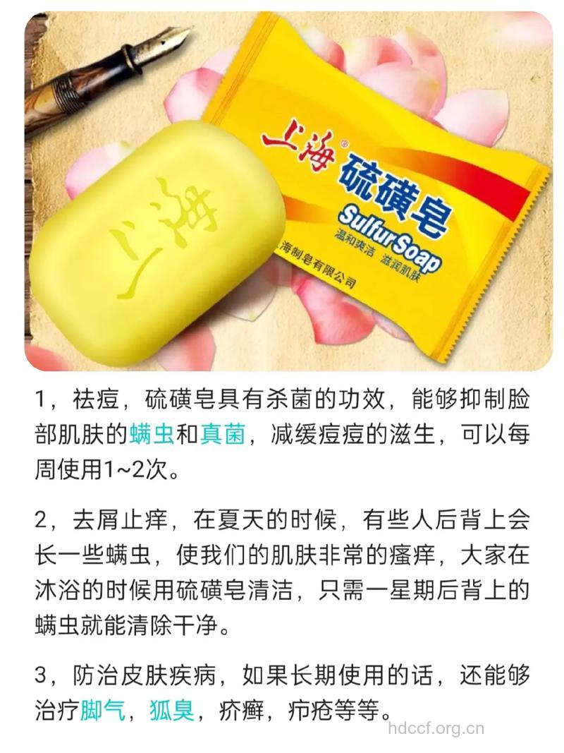 硫磺皂能用来治疗荨麻疹吗