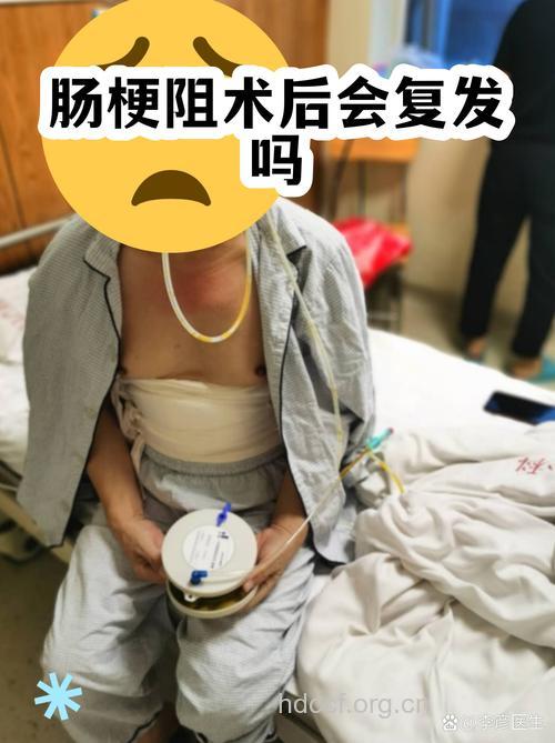 肠梗阻手术后为何难痊愈?