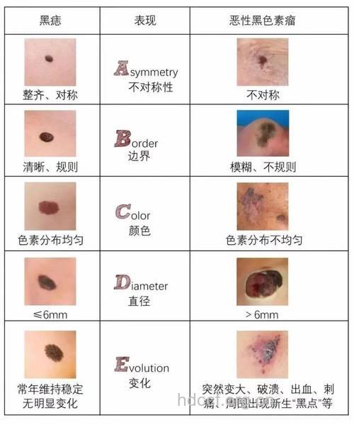 频繁染发可能会导致皮肤癌