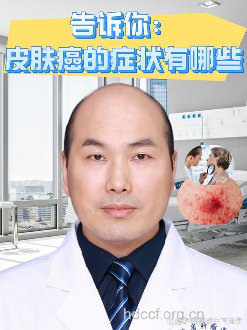 精神刺激会导致皮肤癌吗