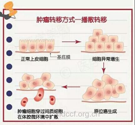 皮肤癌的转移途径是什么