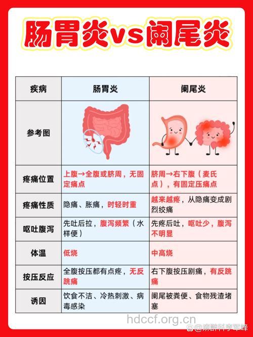 慢性阑尾炎有关常识