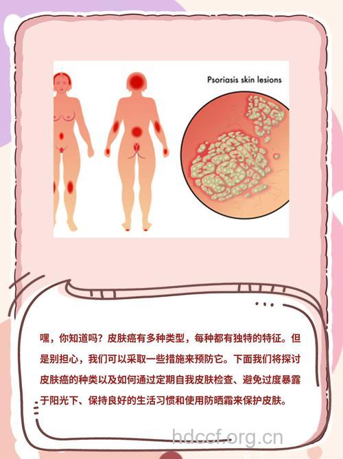 皮肤癌的分类及临床症状