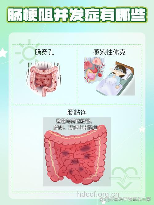 认识肠梗阻的并发症