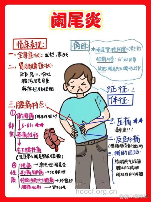 慢性阑尾炎有关的常识