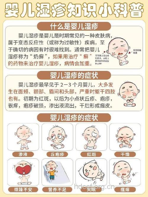 婴儿湿疹与缺钙有关