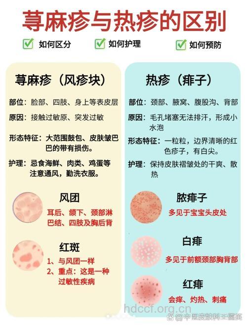 慢性荨麻疹的病因