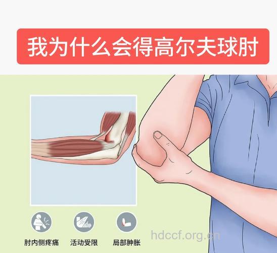 患上高尔夫球肘怎么办?
