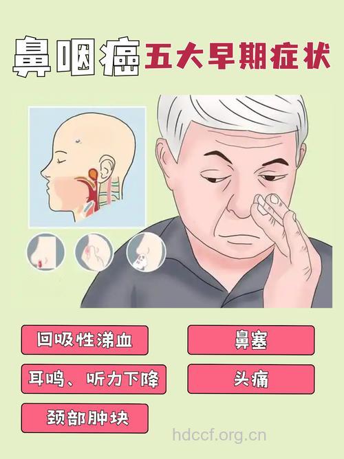 鼻咽癌常见的几种早期症状