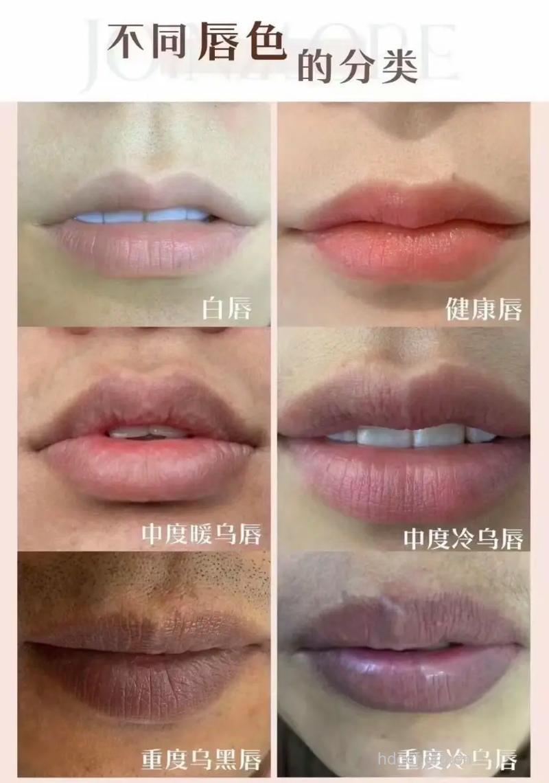 从你的唇看你健康与否?