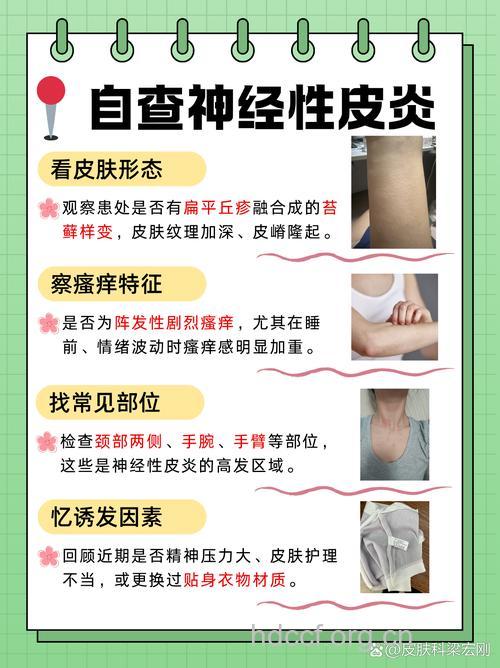 诱发神经性皮炎的原因