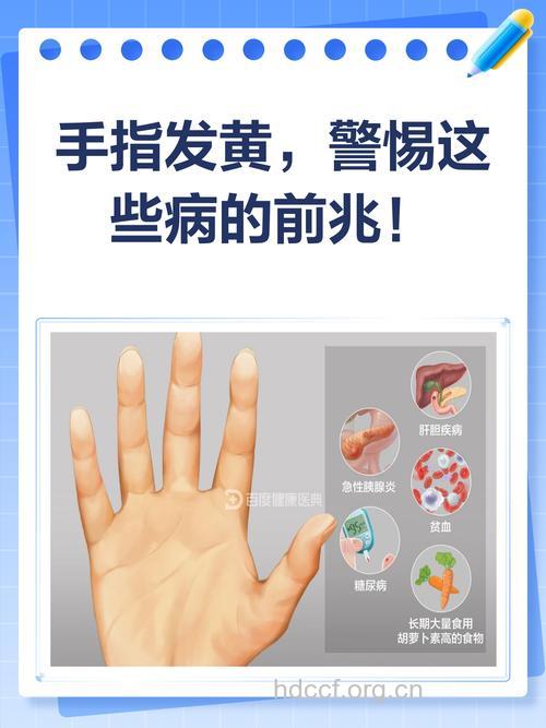 手指发黄是肝病的信号吗