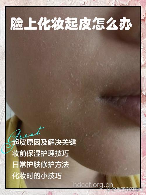 由化妆品产生的皮炎该怎么处理