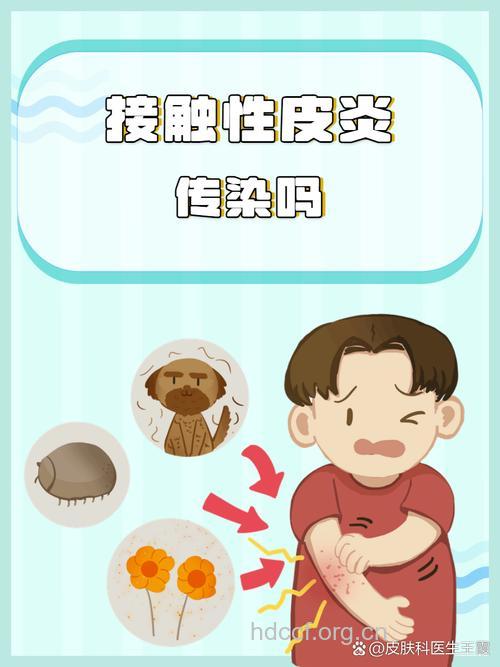 接触性皮炎病因是什么?会传染吗?
