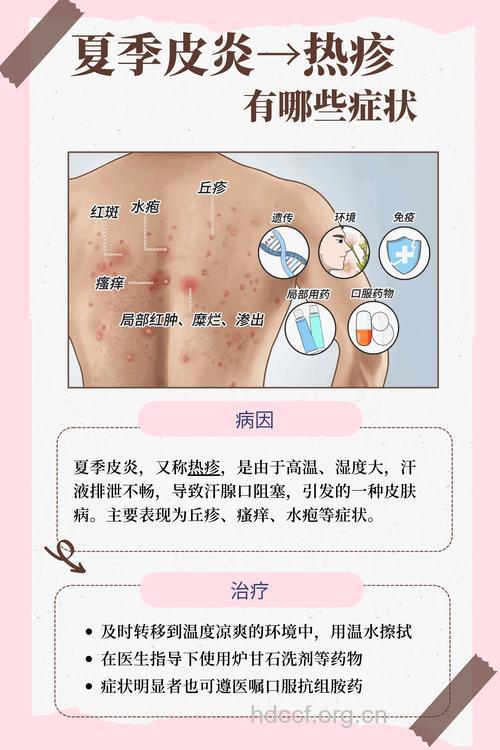 夏日如何预防凉席皮炎？