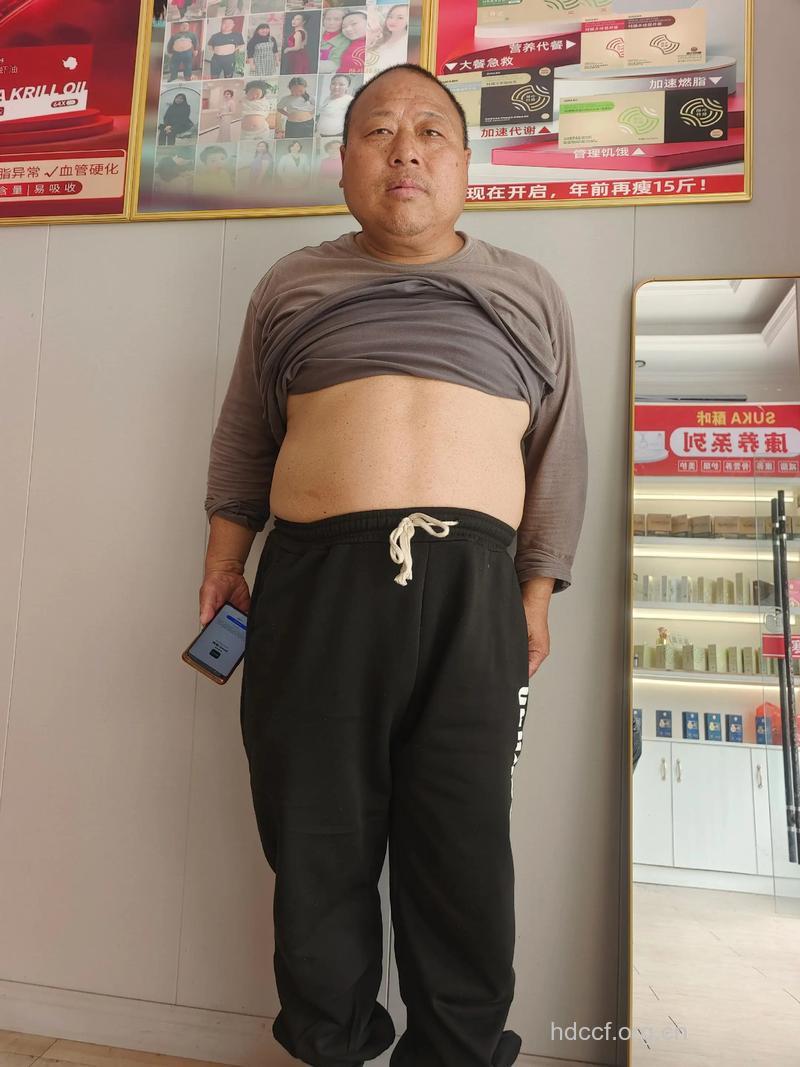 男人有了啤酒肚怎么办？