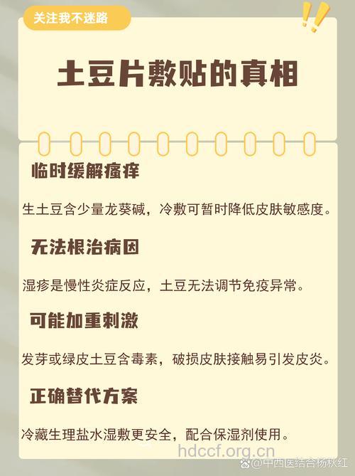土豆治疗湿疹是真的吗 原理是什么