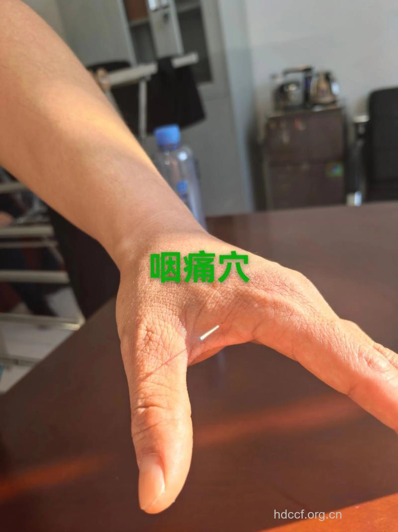 中医有哪些针灸治疗鼻咽癌方法