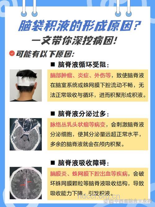 脑积水的原因 脑积水从何而来