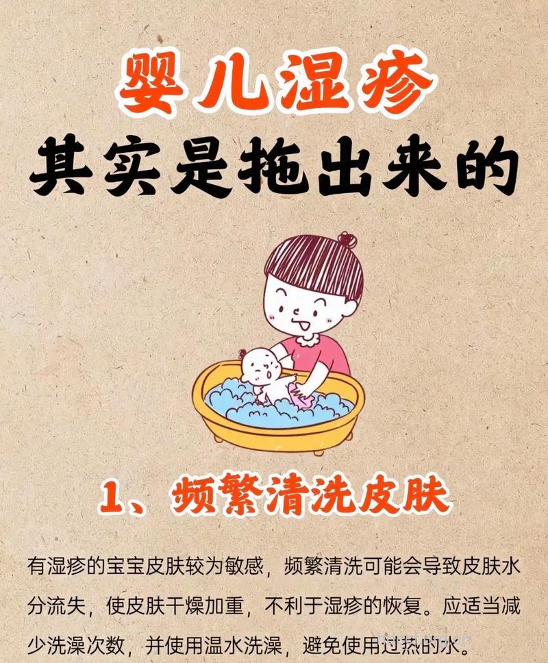 杜绝小儿湿疹的9个小妙招