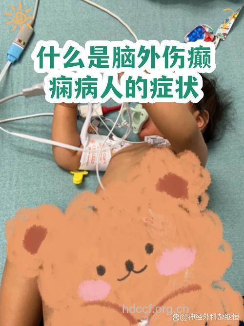 什么是脑外伤癫痫