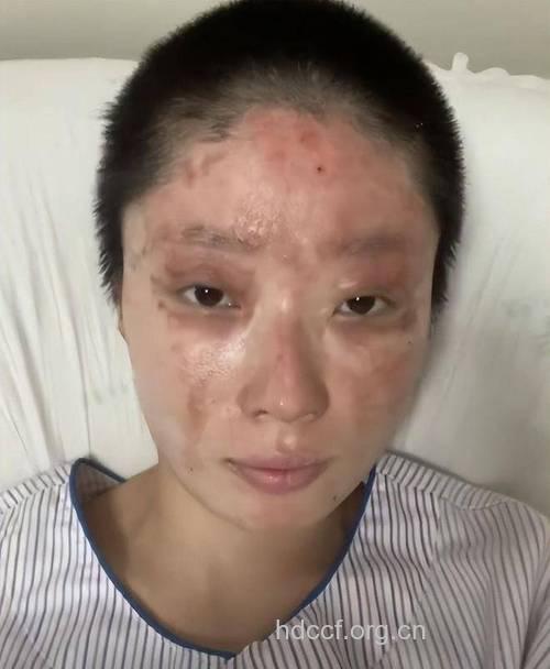 女性毁容十二食物大盘点