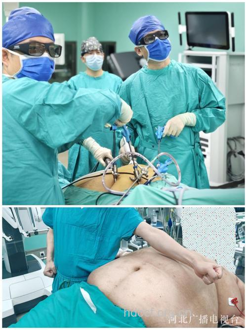 2010流行的减肥瘦身手术