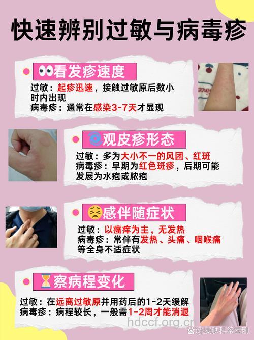 导致湿疹的过敏原有哪些