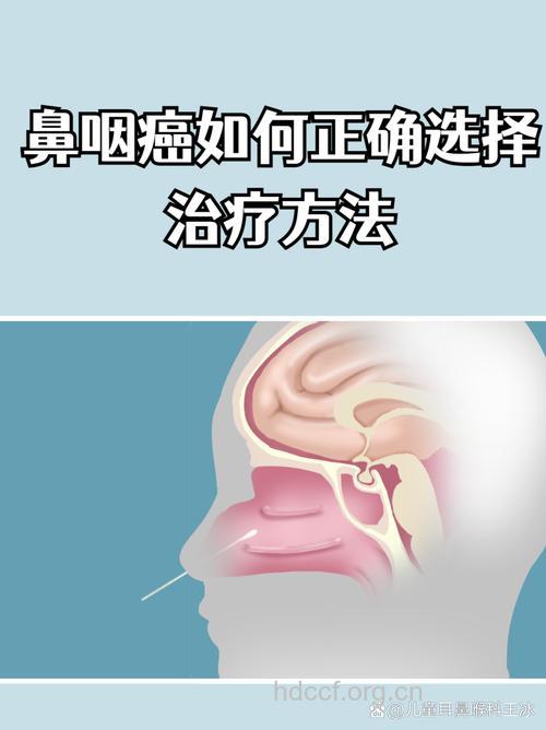 生物免疫治疗鼻咽癌好吗