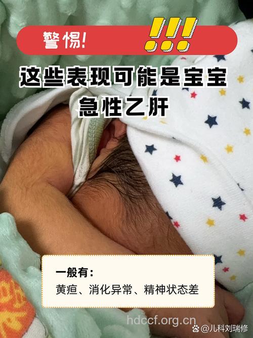 宝宝得了乙肝有哪些症状