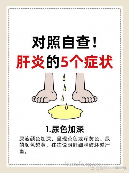 怎么从尿液判断肝脏健康方法