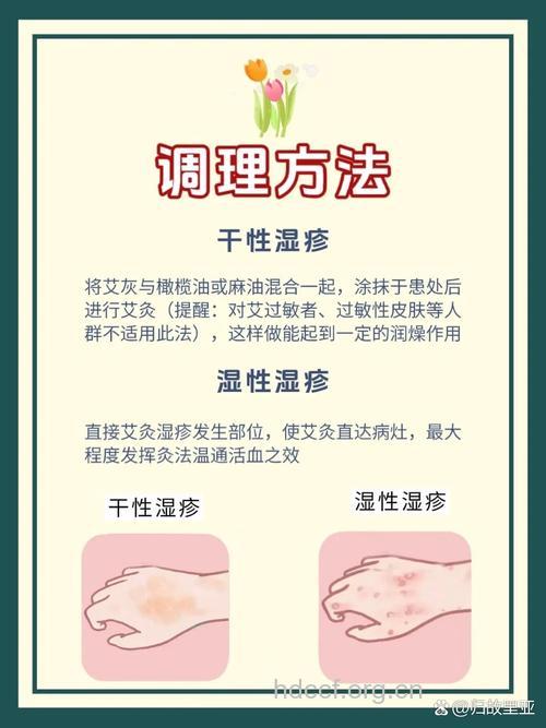 怎么正确治疗慢性湿疹方法