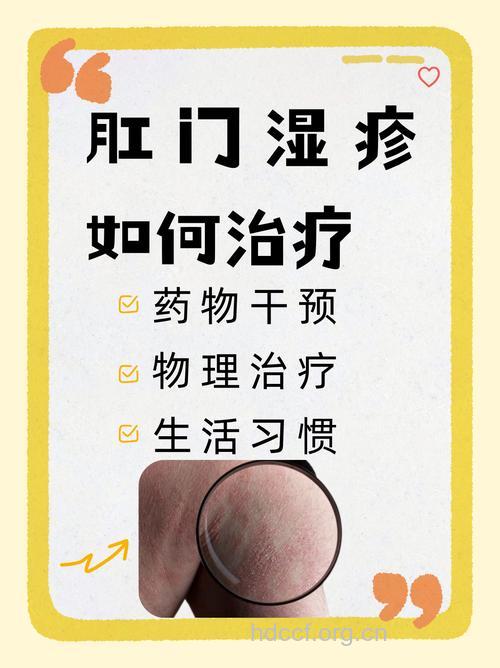 肛门湿疹有哪些治疗方法