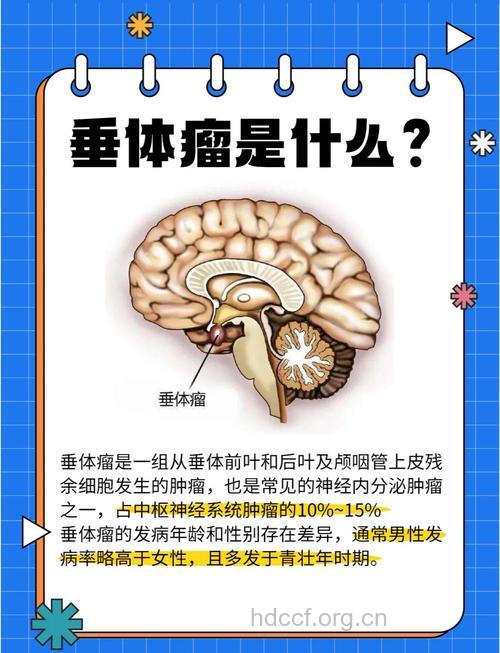 关于垂体瘤有哪些症状