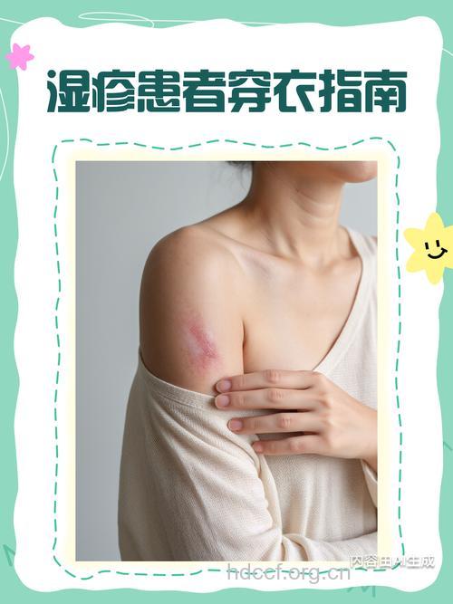 湿疹患者穿衣服有哪些讲究