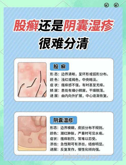 怎么正确认识阴囊湿疹