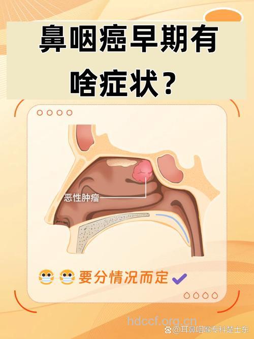 鼻咽癌与什么有关呢